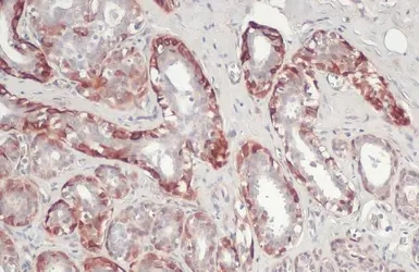 NELL1 antibody [C1C3]