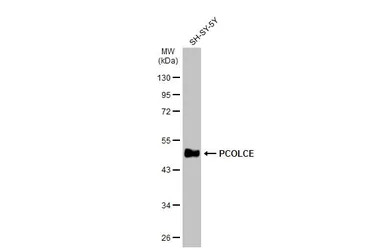 PCOLCE antibody [N1C3]