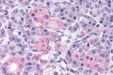 PTHR2 / PTH2R antibody