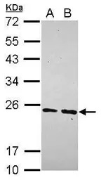 MRPS23 antibody [N1C3]