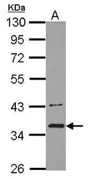 BRCC36 antibody [N1C3]
