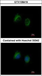 IL1F7 antibody [C2C3], C-term