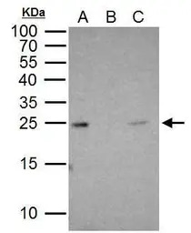 RAB5A antibody