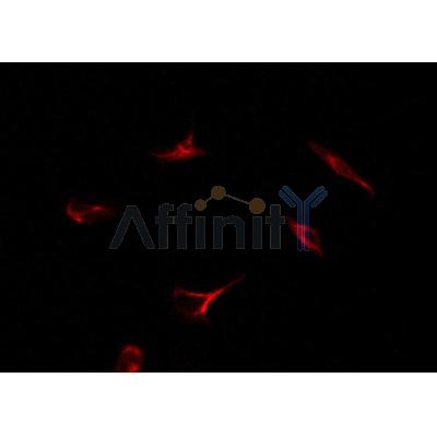 AF6058 Estrogen Receptor-alpha Antibody IF/ICC 293