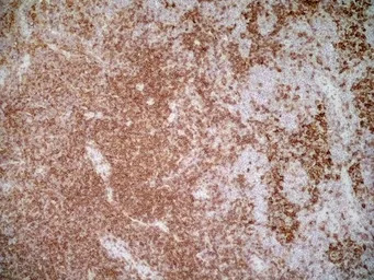 CD4 antibody [OX-35]