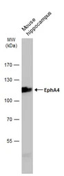 EphA4 antibody [N3C2-2], Inter