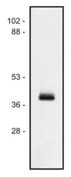 HLA Class I antibody [MEM-147]