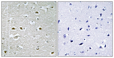 URB1 antibody