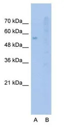 SLC22A1 antibody, N-term