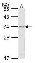 RPA32 antibody [N1C3]