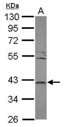 LRRC23 antibody