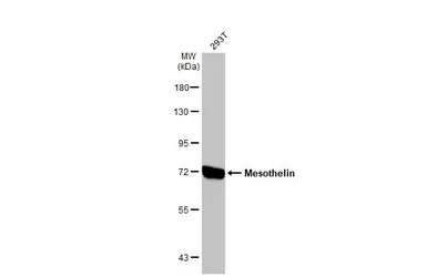 Mesothelin antibody [N1C2]