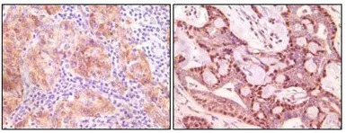 gamma Synuclein antibody [1H10