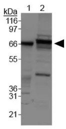 ABCF2 antibody