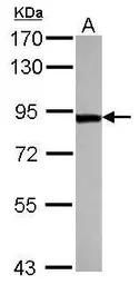 ThrRS antibody