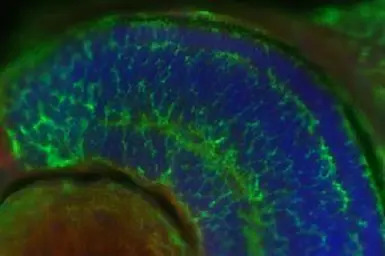 PSMC3 antibody [N1C2]