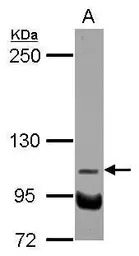 NDST3 antibody