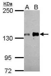 AXL antibody
