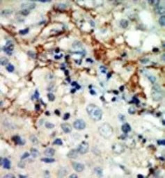 EphA3 antibody, N-term