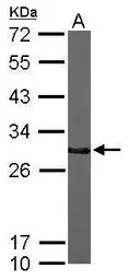 CTDSP2 antibody
