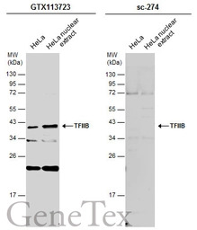 TFIIB antibody [N2C3]