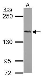 PHLPP2 antibody [N1N2], N-term
