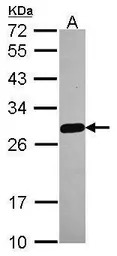 MED18 antibody [N1C3]