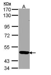 STK33 antibody [N1C3]