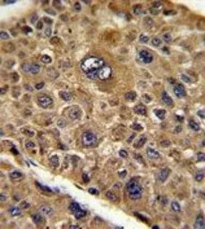 TOB1 antibody, N-term