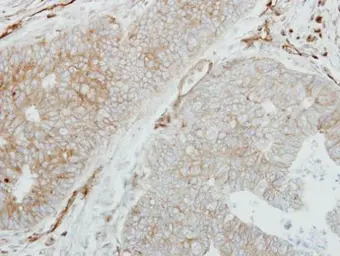 HLA-DMB antibody [C2C3], C-ter