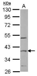 SPOP antibody [N1C1]
