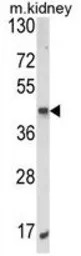 ALKBH3 antibody, C-term