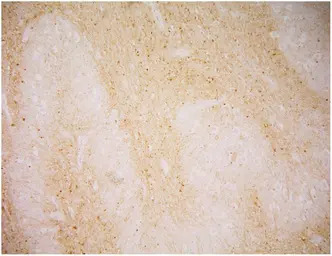 PSMA antibody [GCP-04]