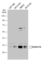RABGGTB antibody