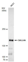 SALL4 antibody [C1C2], Interna