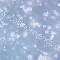 Walker/LLC-WRC 256 大鼠腹水癌细胞/STR鉴定