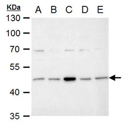 IDH1 antibody