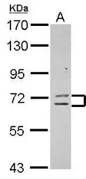 ZNF182 antibody