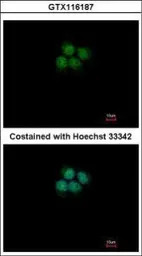 CPSF73 antibody