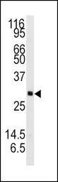 Neurotrophin 3 antibody, C-ter