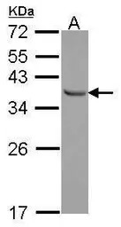 E2F6 antibody