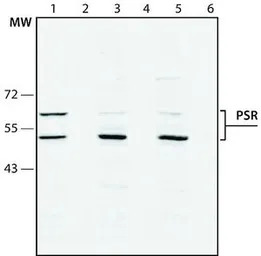 PSR antibody