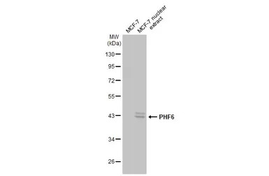 PHF6 antibody [N2C2], Internal