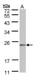 HRPAP20 antibody [N1C3]