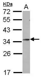 GSC antibody [N1C3]