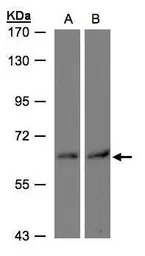 DAK antibody