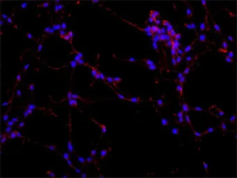 MAP2 antibody [AP-20]