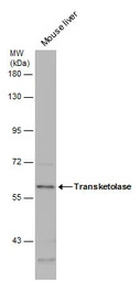 Transketolase antibody [N3C2],