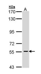 CDC73 antibody [N1C1]