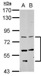 CCDC114 antibody